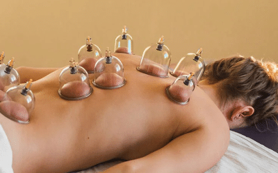 Cupping Therapie