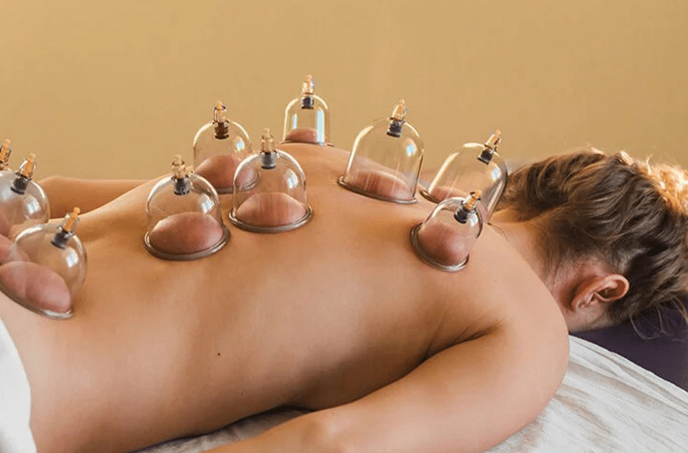 Cupping Therapie